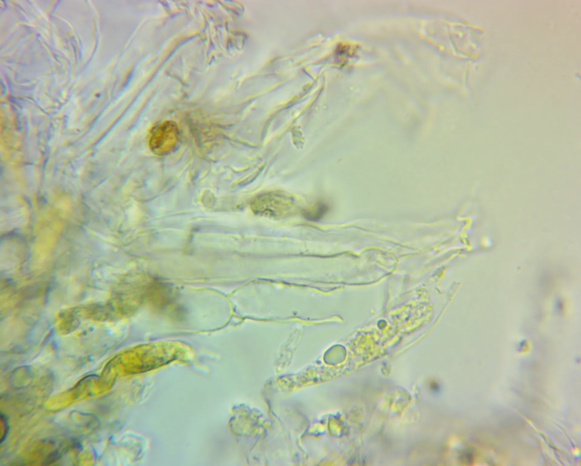 Microscopía de Cortinarius cingulatus - basidios (1)